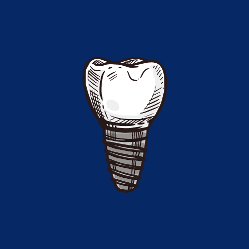 tms-dental-implants